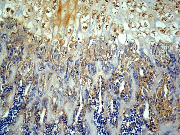 MMP-13 Antibody in Immunohistochemistry (Paraffin) (IHC (P))