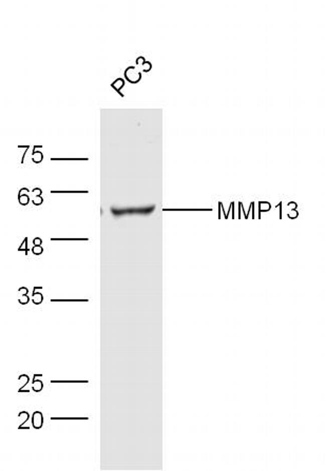 MMP-13 Antibody in Western Blot (WB)