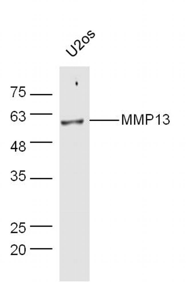 MMP-13 Antibody in Western Blot (WB)