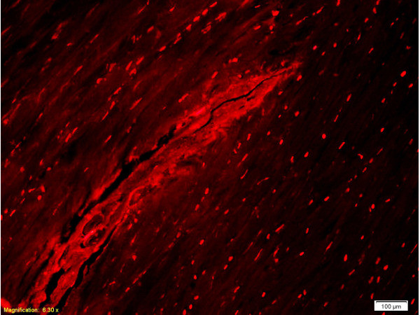 Collagen 1 Antibody in Immunohistochemistry (Paraffin) (IHC (P))