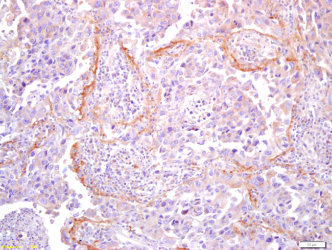 Collagen 1 Antibody in Immunohistochemistry (Paraffin) (IHC (P))