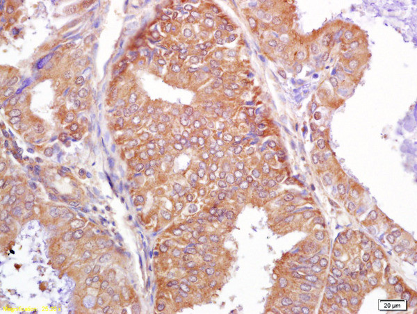 PALB2 Antibody in Immunohistochemistry (Paraffin) (IHC (P))