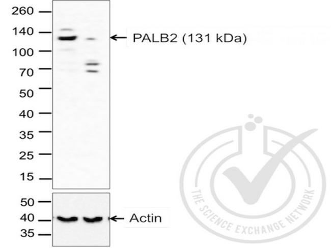 PALB2 Antibody in Western Blot (WB)