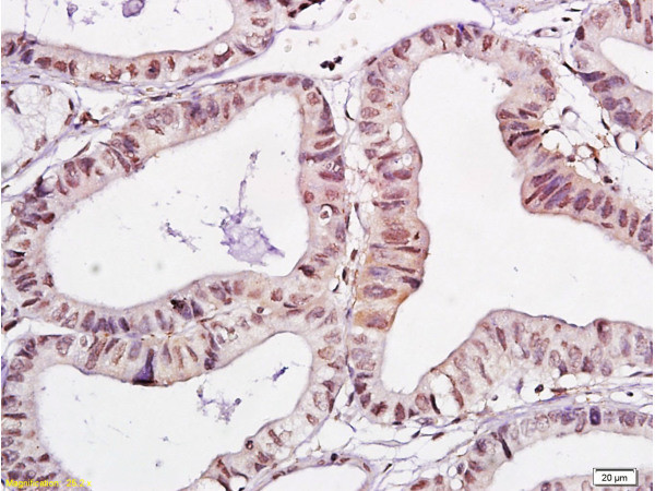 WWOX Antibody in Immunohistochemistry (Paraffin) (IHC (P))