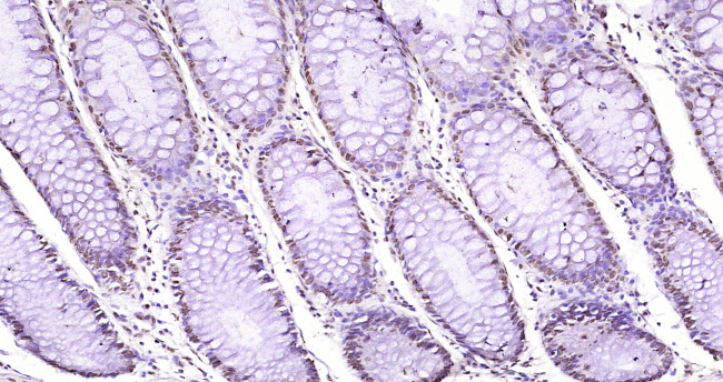 WWOX Antibody in Immunohistochemistry (Paraffin) (IHC (P))