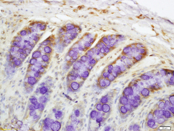 DR4 Antibody in Immunohistochemistry (Paraffin) (IHC (P))