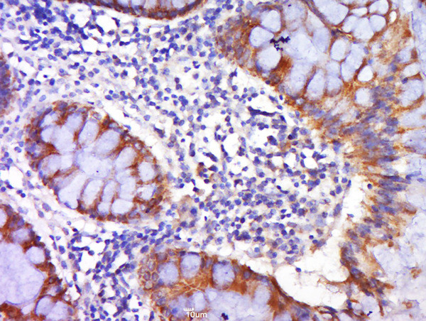 DR4 Antibody in Immunohistochemistry (Paraffin) (IHC (P))