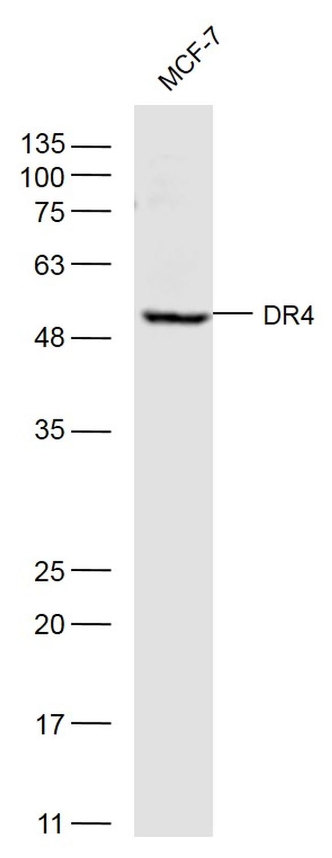 DR4 Antibody in Western Blot (WB)