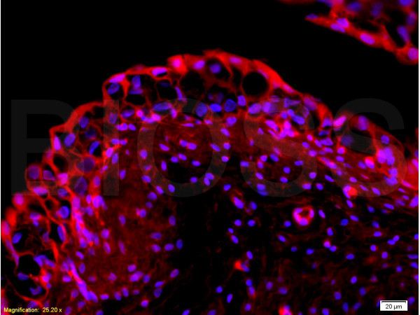 EpCAM Antibody in Immunohistochemistry (Paraffin) (IHC (P))