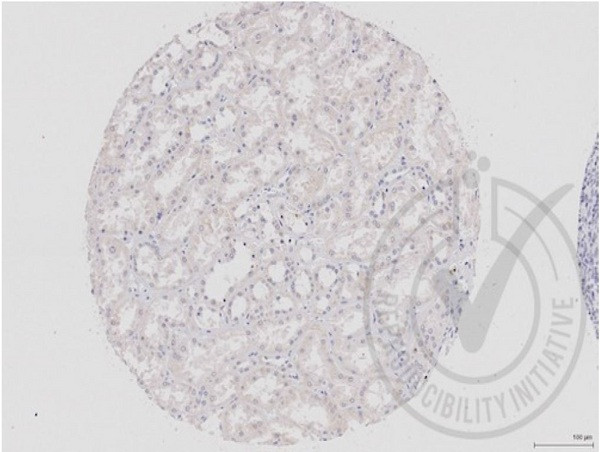 DVL1 Antibody in Immunohistochemistry (Paraffin) (IHC (P))