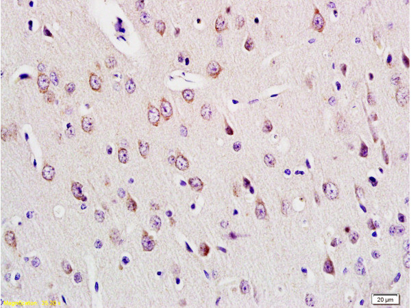 E2F1 Antibody in Immunohistochemistry (Paraffin) (IHC (P))