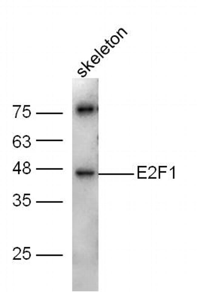 E2F1 Antibody in Western Blot (WB)