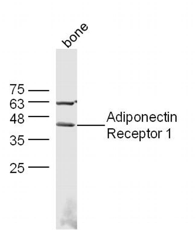 Adiponectin Receptor 1 Antibody in Western Blot (WB)