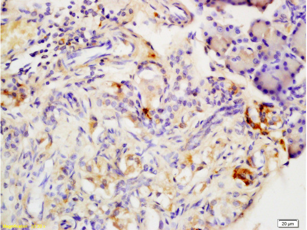 Adiponectin receptor 2 Antibody in Immunohistochemistry (Paraffin) (IHC (P))