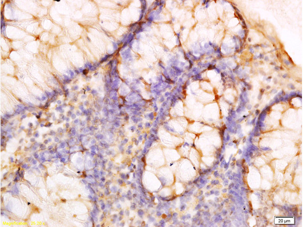 Adiponectin receptor 2 Antibody in Immunohistochemistry (Paraffin) (IHC (P))