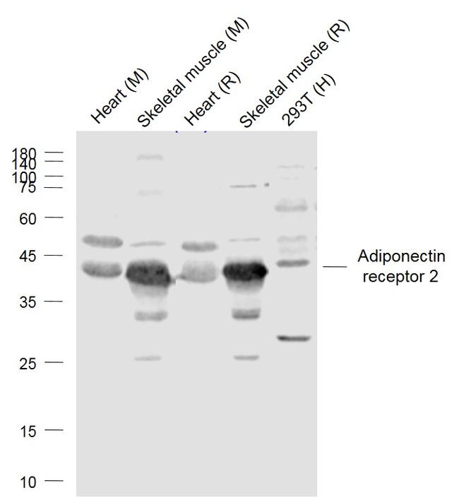 Adiponectin receptor 2 Antibody in Western Blot (WB)