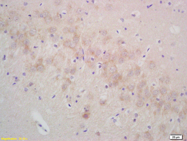 gamma Synuclein Antibody in Immunohistochemistry (Paraffin) (IHC (P))