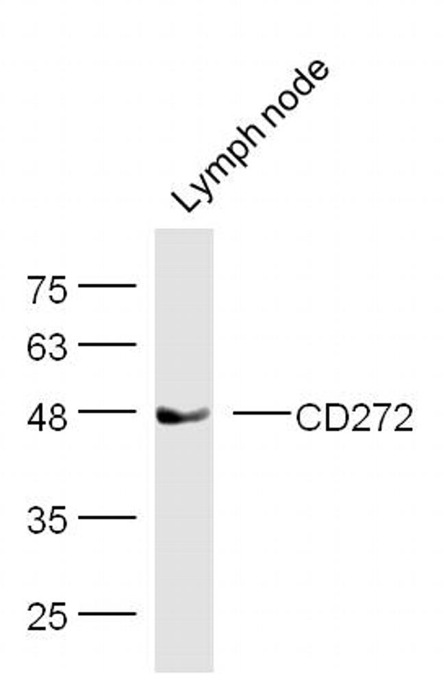 CD272 Antibody in Western Blot (WB)