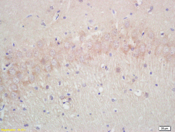 Aquaporin 4 Antibody in Immunohistochemistry (Paraffin) (IHC (P))