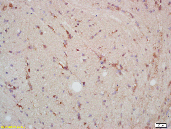 P38 MAPK Antibody in Immunohistochemistry (Paraffin) (IHC (P))