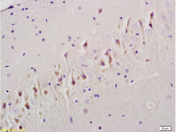 TGF beta Receptor 1 Antibody in Immunohistochemistry (Paraffin) (IHC (P))