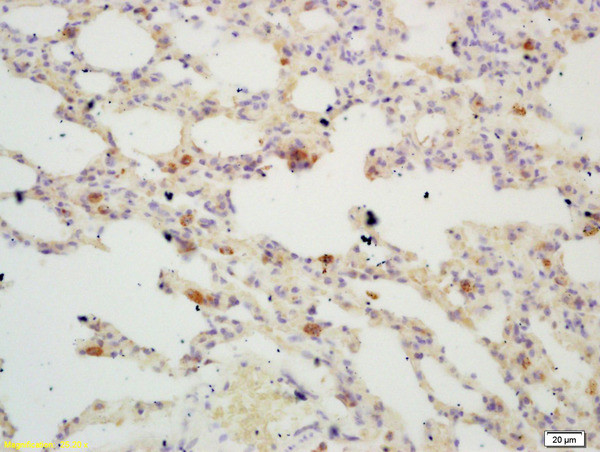 TIGAR Antibody in Immunohistochemistry (Paraffin) (IHC (P))