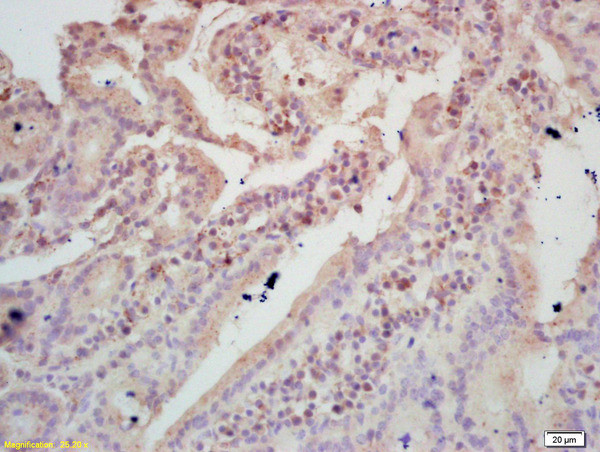 TIGAR Antibody in Immunohistochemistry (Paraffin) (IHC (P))