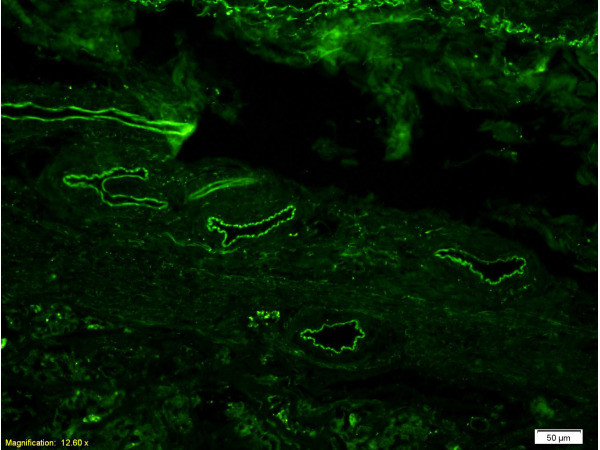 CD34 Antibody in Immunohistochemistry (Paraffin) (IHC (P))