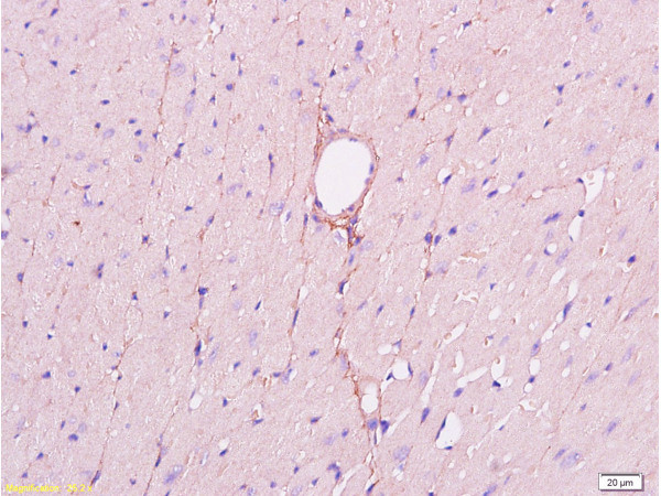 CD34 Antibody in Immunohistochemistry (Paraffin) (IHC (P))