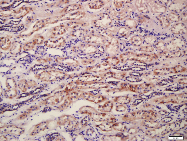 CD34 Antibody in Immunohistochemistry (Paraffin) (IHC (P))