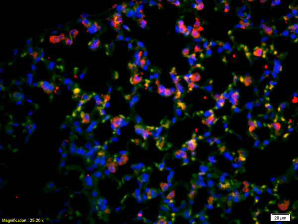 CD4 Antibody in Immunohistochemistry (Paraffin) (IHC (P))