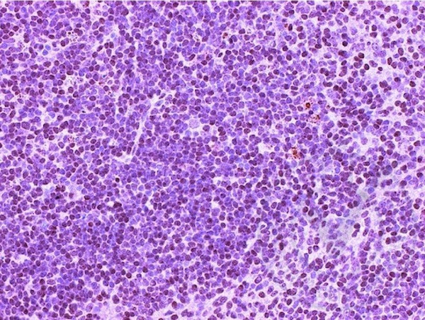 CD4 Antibody in Immunohistochemistry (Paraffin) (IHC (P))