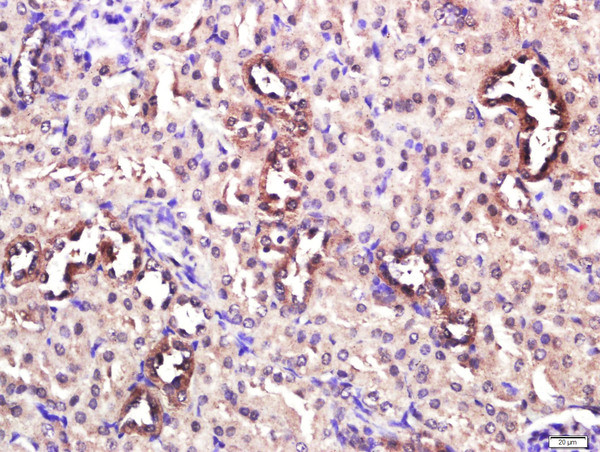 CD4 Antibody in Immunohistochemistry (Paraffin) (IHC (P))