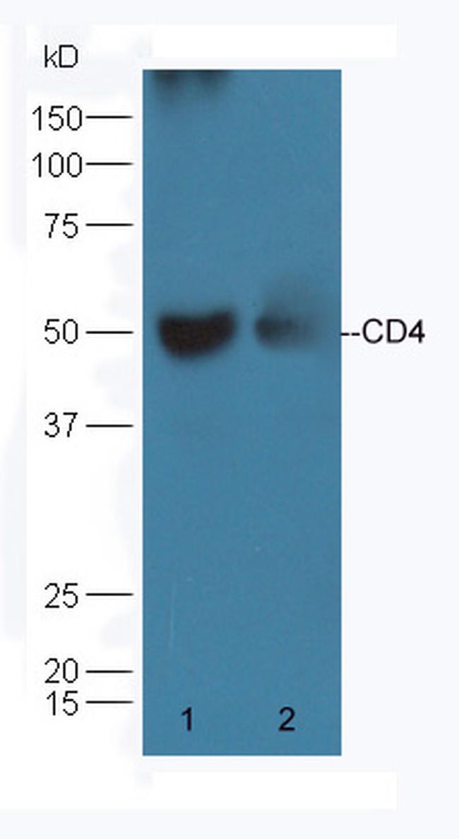 CD4 Antibody in Western Blot (WB)