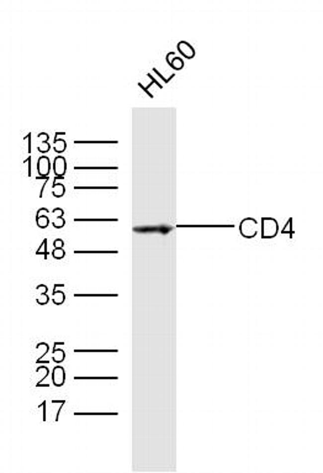 CD4 Antibody in Western Blot (WB)