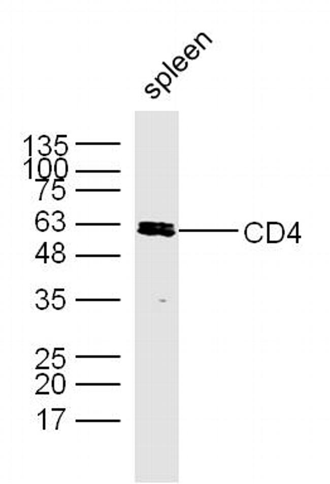 CD4 Antibody in Western Blot (WB)