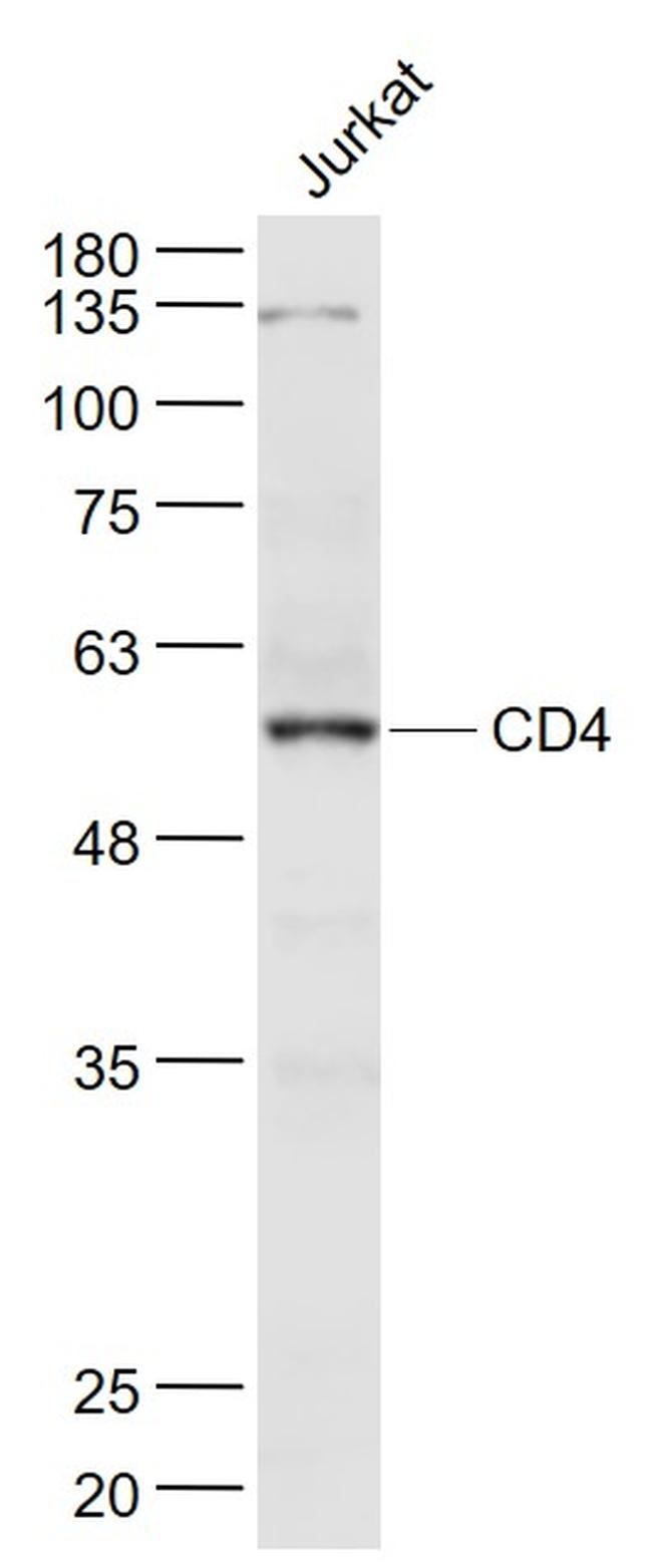 CD4 Antibody in Western Blot (WB)