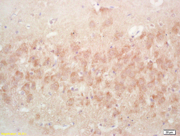 PAK5 Antibody in Immunohistochemistry (Paraffin) (IHC (P))