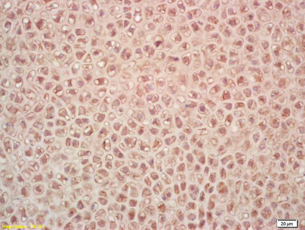 PAK5 Antibody in Immunohistochemistry (Paraffin) (IHC (P))