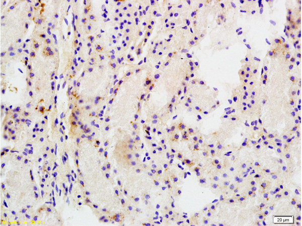 MRP1 Antibody in Immunohistochemistry (Paraffin) (IHC (P))