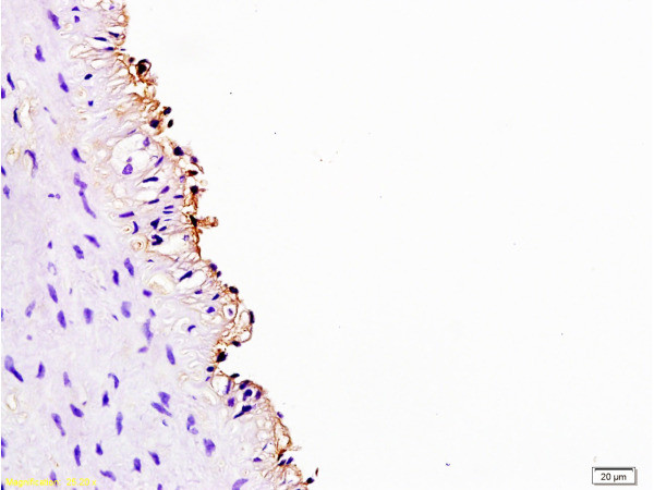 Cyclin D3 Antibody in Immunohistochemistry (Paraffin) (IHC (P))