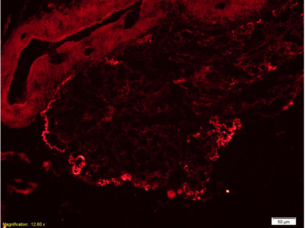 Fibronectin Antibody in Immunohistochemistry (Paraffin) (IHC (P))