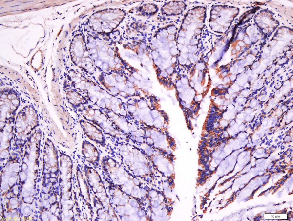 Fibronectin Antibody in Immunohistochemistry (Paraffin) (IHC (P))