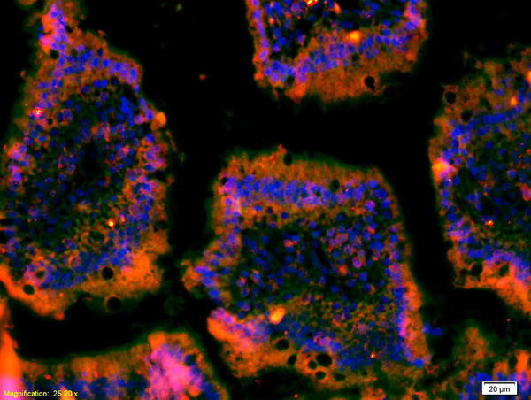 Met (c-Met) Antibody in Immunohistochemistry (Paraffin) (IHC (P))