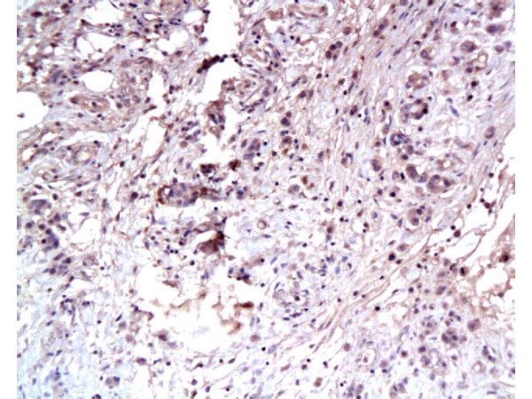 Met (c-Met) Antibody in Immunohistochemistry (Paraffin) (IHC (P))