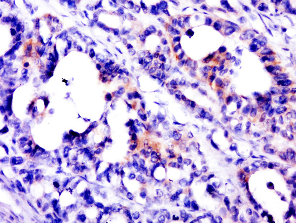 PSCA Antibody in Immunohistochemistry (Paraffin) (IHC (P))