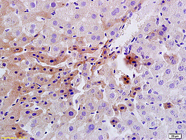 Insulin Receptor Antibody in Immunohistochemistry (Paraffin) (IHC (P))