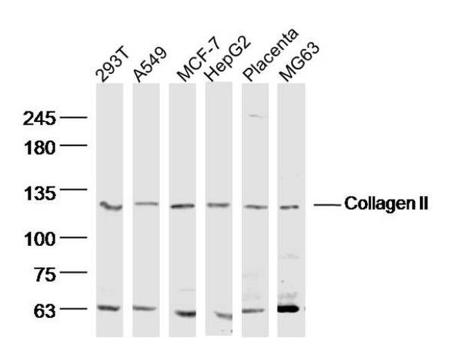 Collagen 2 Antibody in Western Blot (WB)