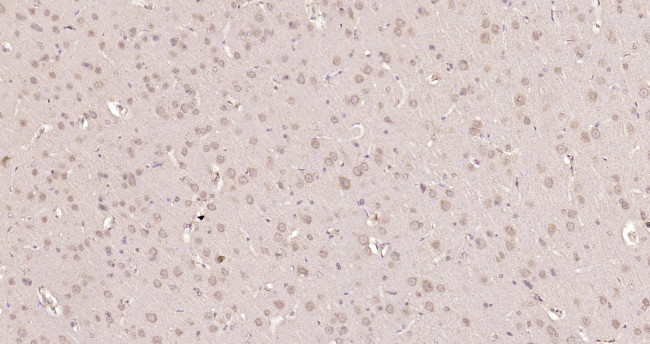 Smad2 Antibody in Immunohistochemistry (Paraffin) (IHC (P))