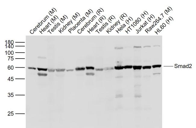 Smad2 Antibody in Western Blot (WB)